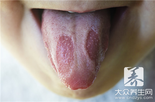 舌头上有红色的小肉粒疼